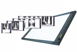 Негатоскопы для просмотра рентгенограмм Dixion X-View Led